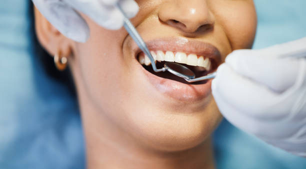 Best Knocked-Out Tooth (Avulsed Tooth) Treatment in Briar Chapel, NC